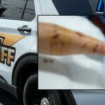 Woman Severely Injured in Alligator Attack at Inverness Park