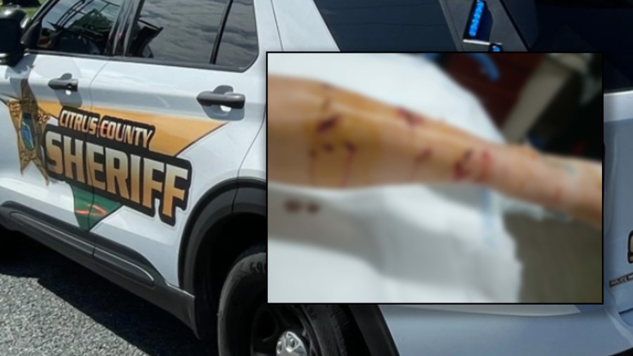 Woman Severely Injured in Alligator Attack at Inverness Park