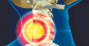 Reverse 'tech neck' and improve posture